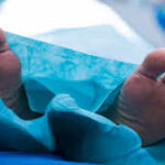 Hombre muere en cirugía de rejuvenecimiento facial en Monterrey; investigan posible negligencia